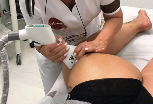 Trattamenti Estetici per il Corpo Torino